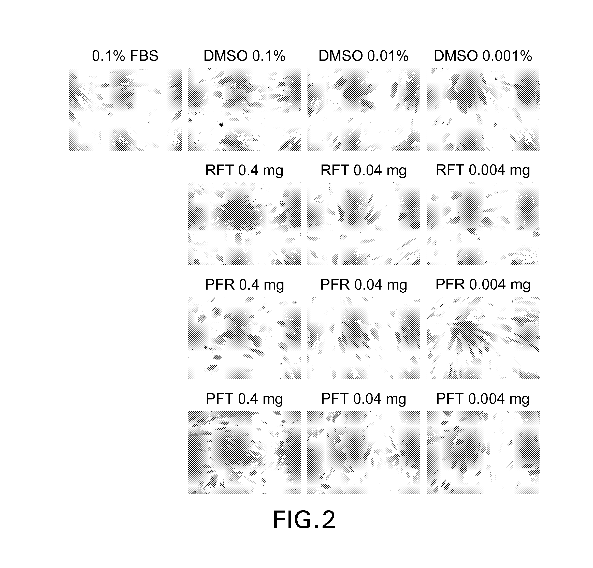 Antioxidant compositions for soft oral tissue and methods of formulation and use thereof