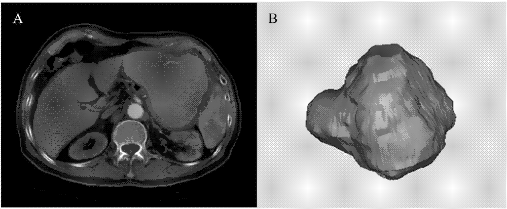 Method for constructing gastrointestinal stromal tumor malignant potential classifying model based on radiomics