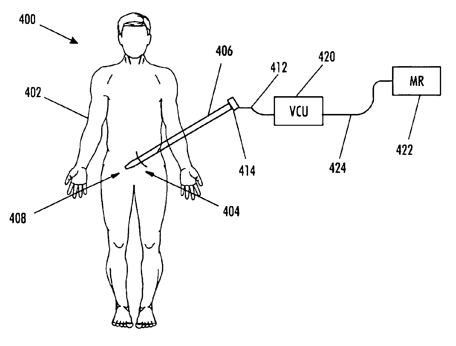 Magnetic resonance imaging interference immune device