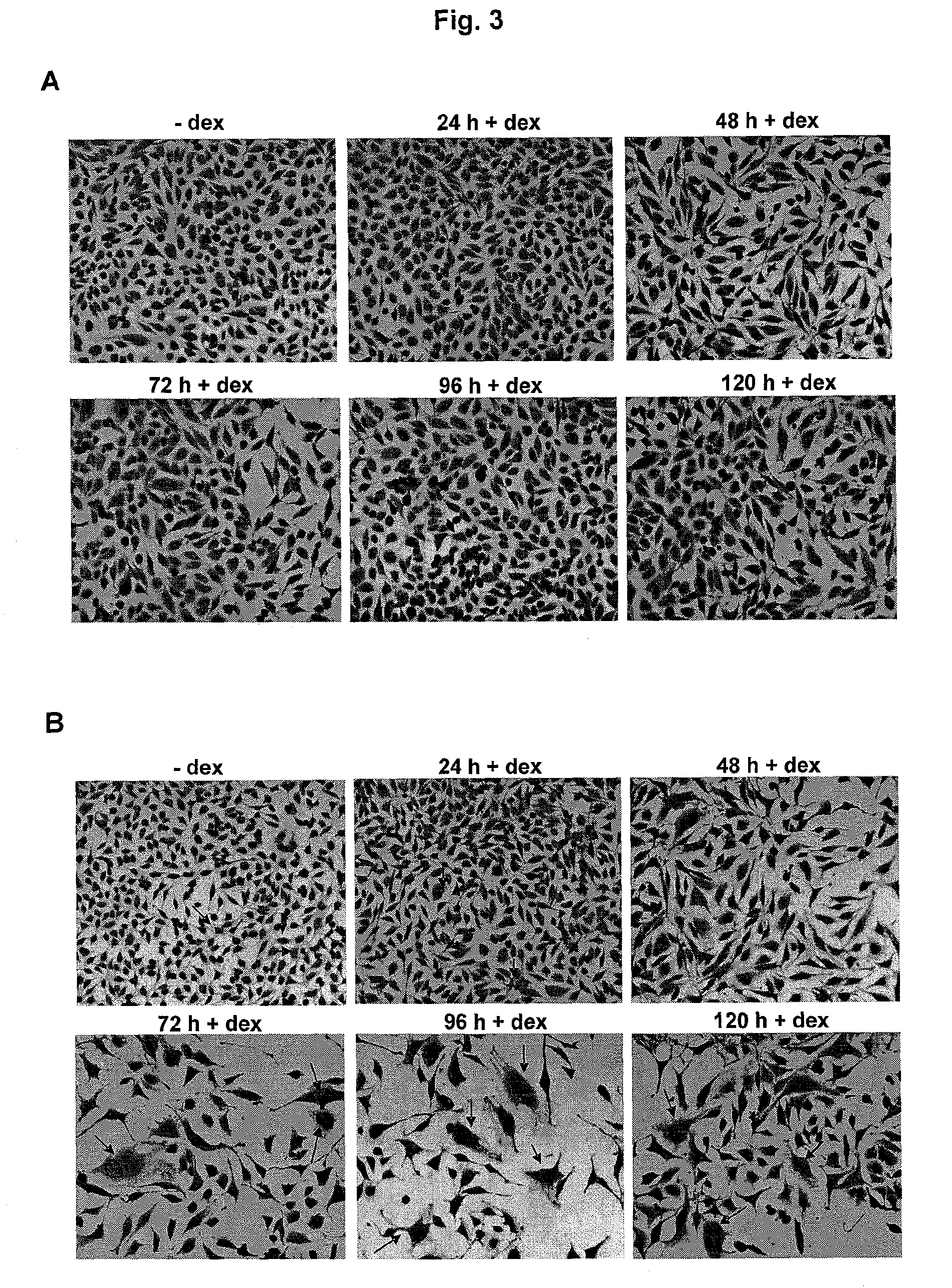 Bacteriophage and prophage proteins in cancer gene therapy