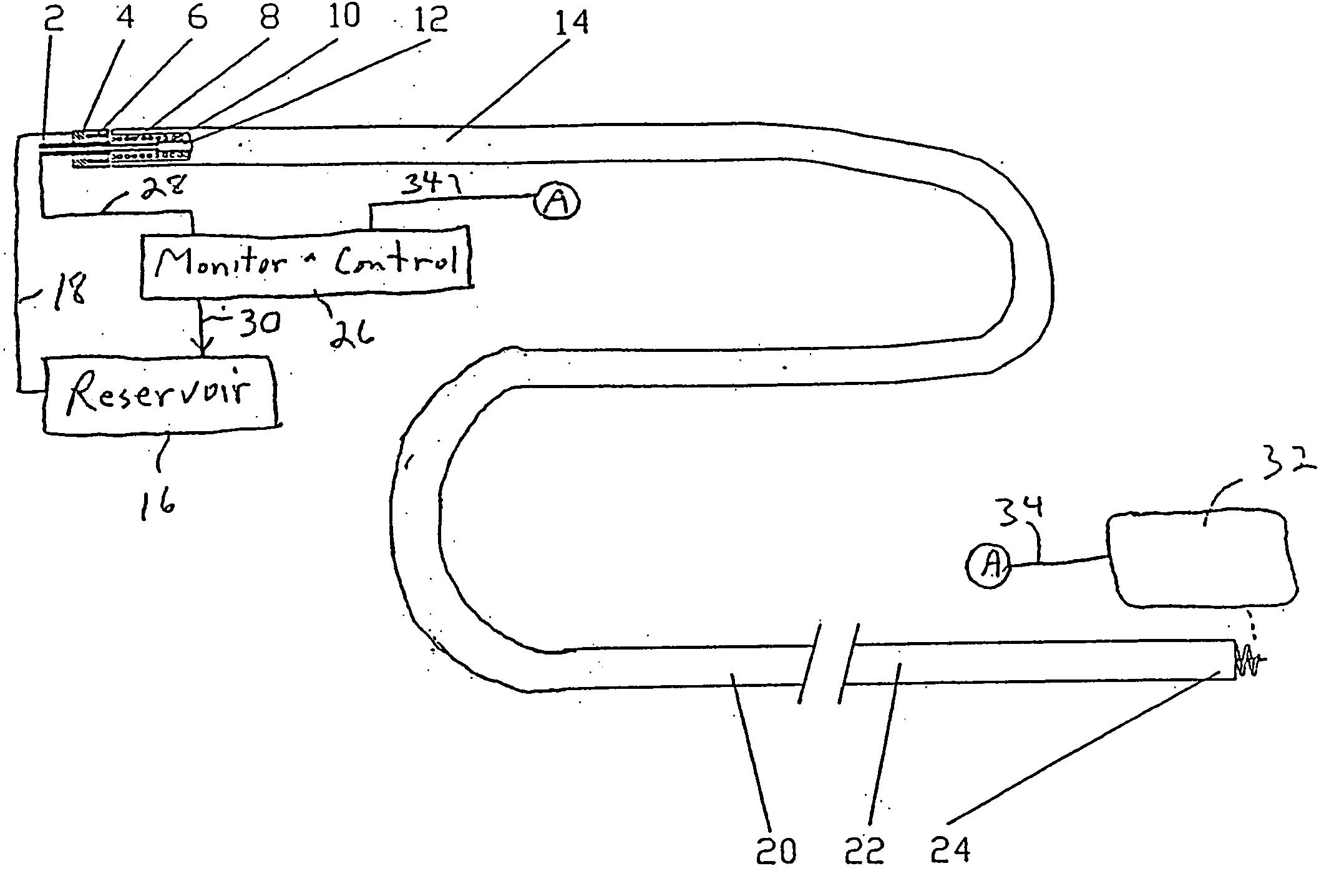 Cardiac drug delivery system and method of use