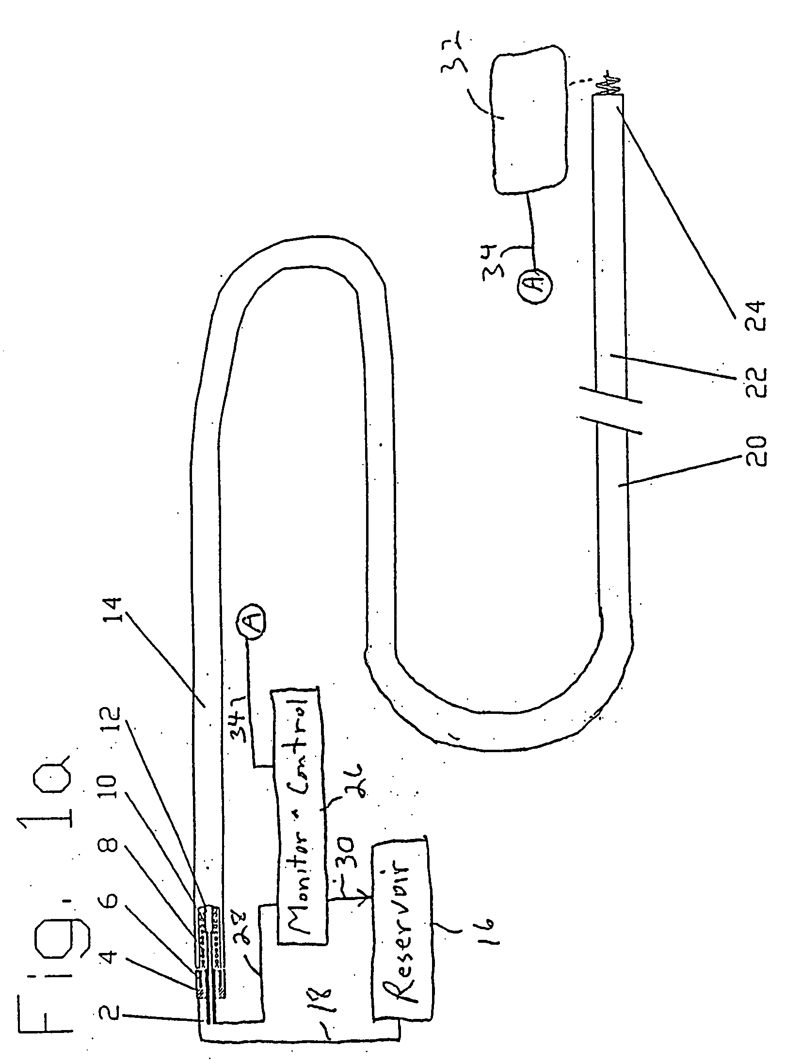 Cardiac drug delivery system and method of use