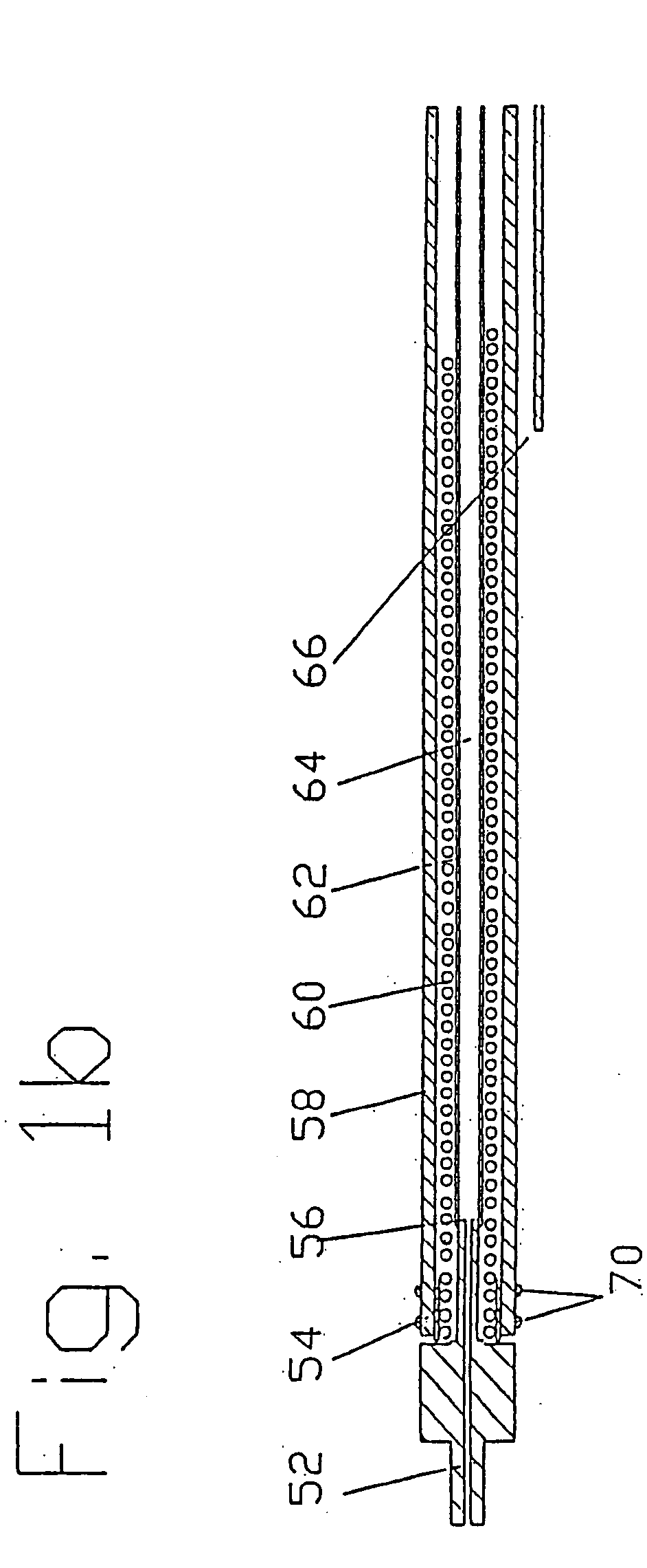 Cardiac drug delivery system and method of use