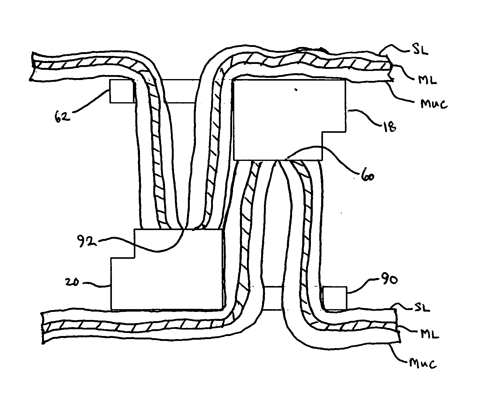 System for tissue approximation and fixation