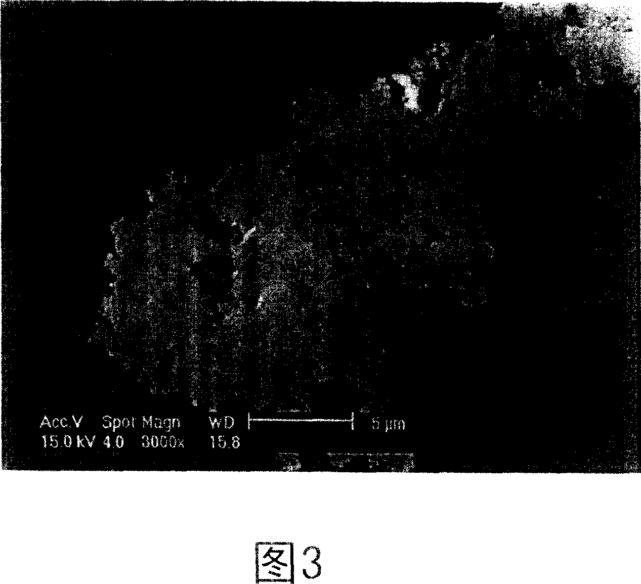 Composite carbon material having metal carbide particles dispersed therein and method for preparation thereof