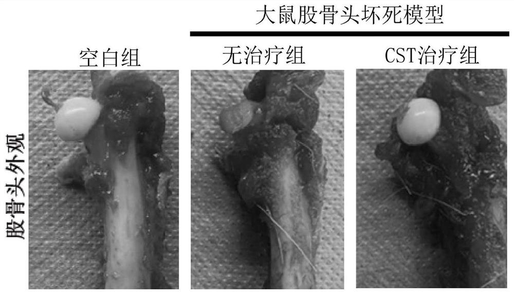 Application of CST polypeptide in preparation of medicine for treating femoral head necrosis