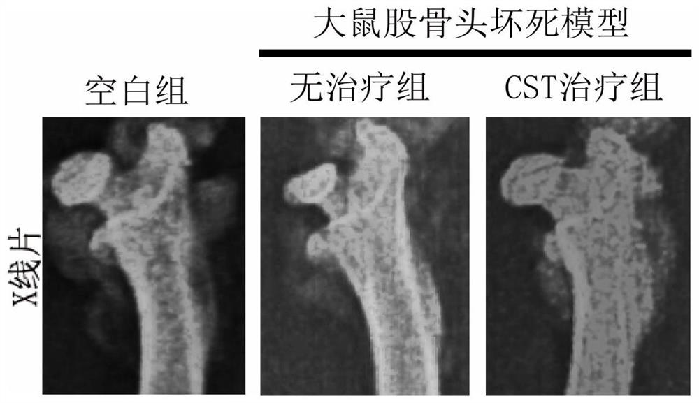 Application of CST polypeptide in preparation of medicine for treating femoral head necrosis