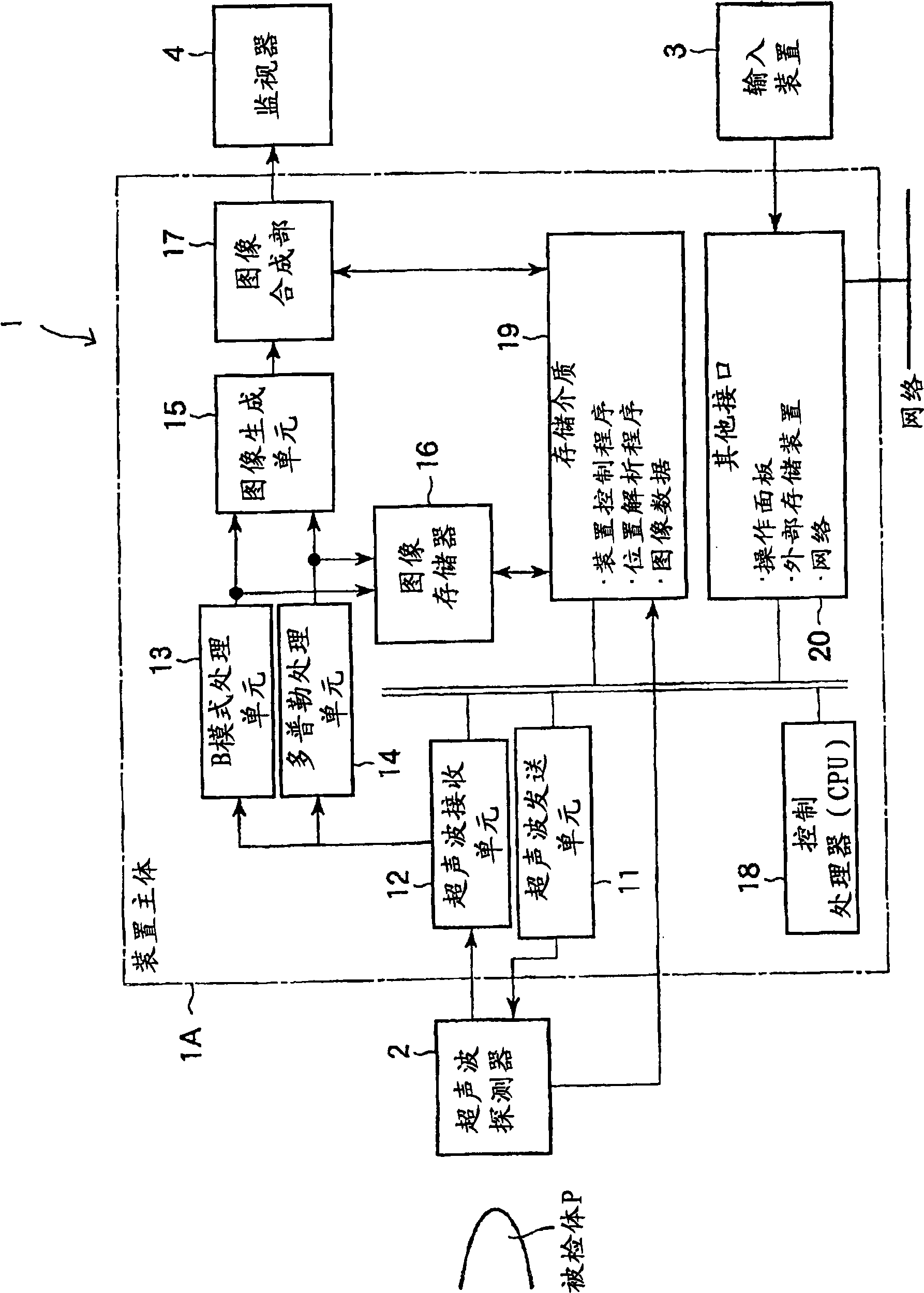 Ultrasonic diagnostic apparatus