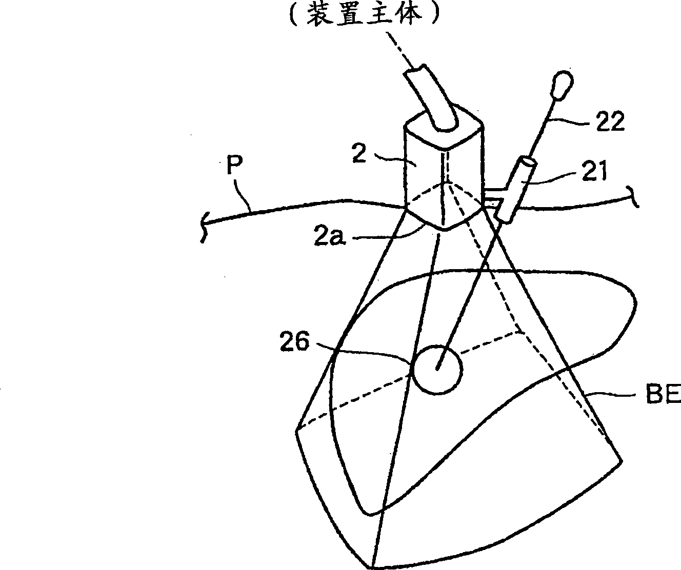 Ultrasonic diagnostic apparatus