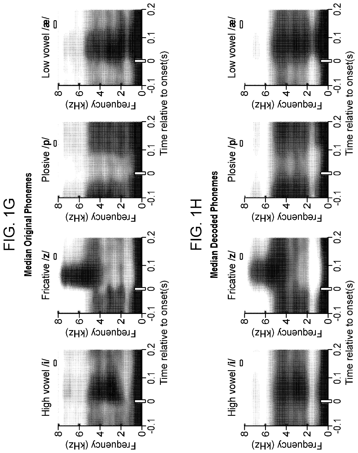 Method of Contextual Speech Decoding from the Brain