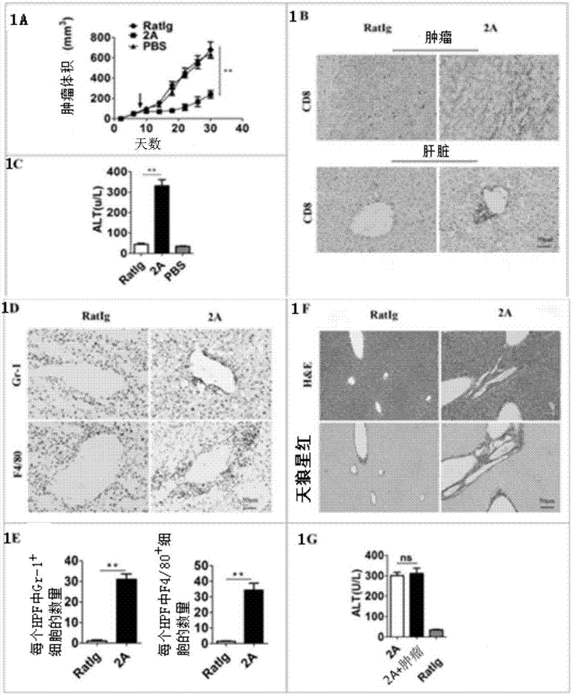 Application of anti-S100A4 antibody in injury of anti-CD137 antibody-mediated antitumor immunity