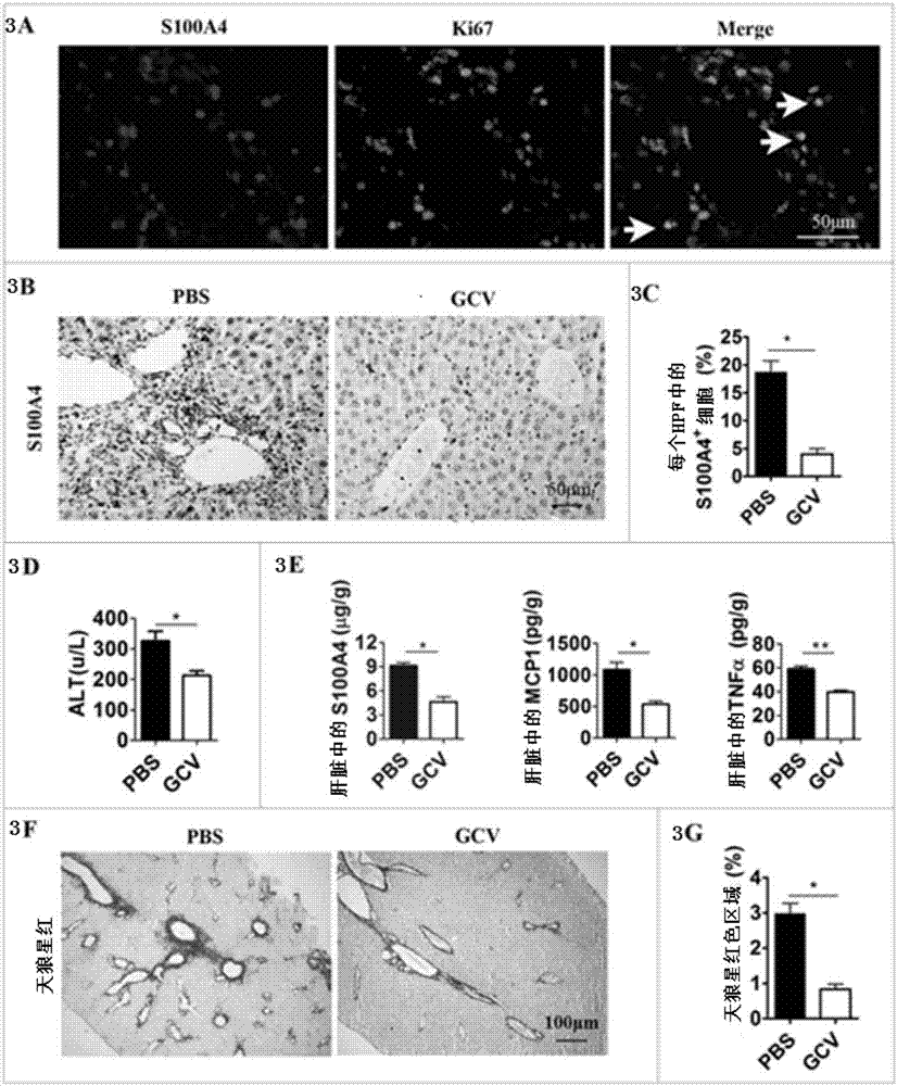 Application of anti-S100A4 antibody in injury of anti-CD137 antibody-mediated antitumor immunity