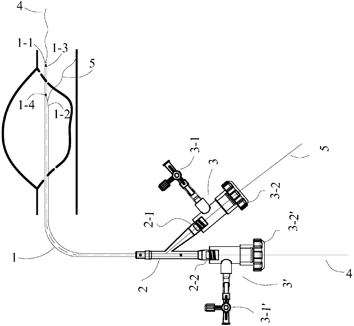 Double-lumen radiography catheter