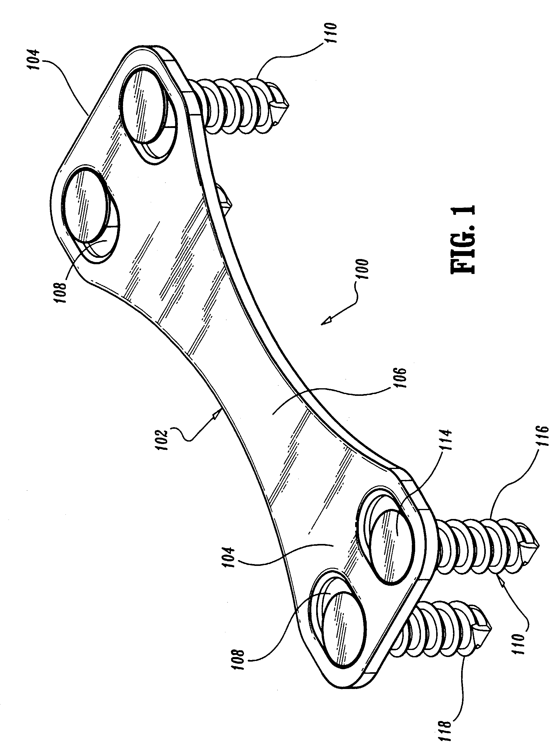 Method of repairing a bone joint