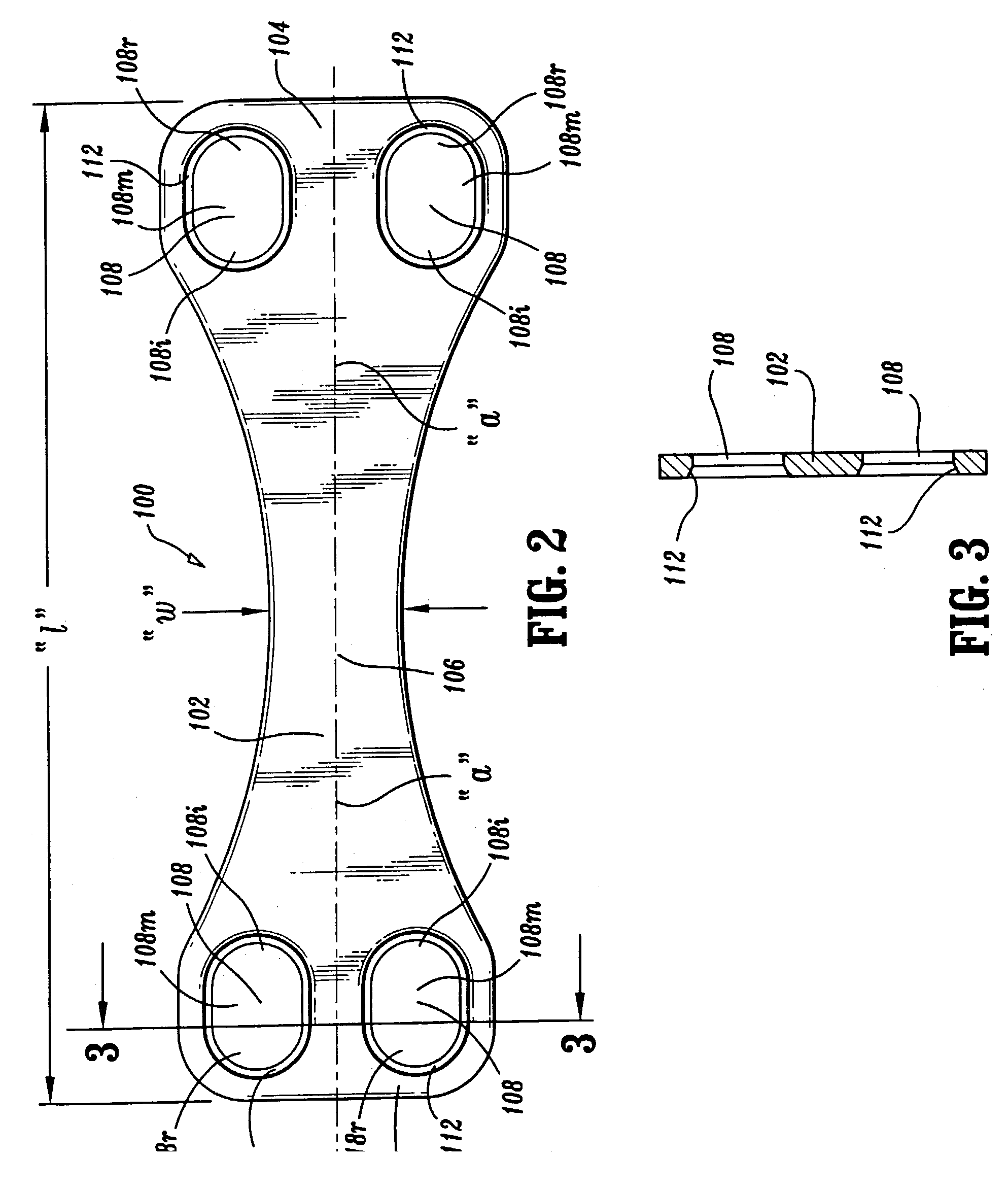 Method of repairing a bone joint