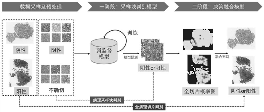 Colorectal cancer digital pathological image discrimination method and system based on weak supervised learning