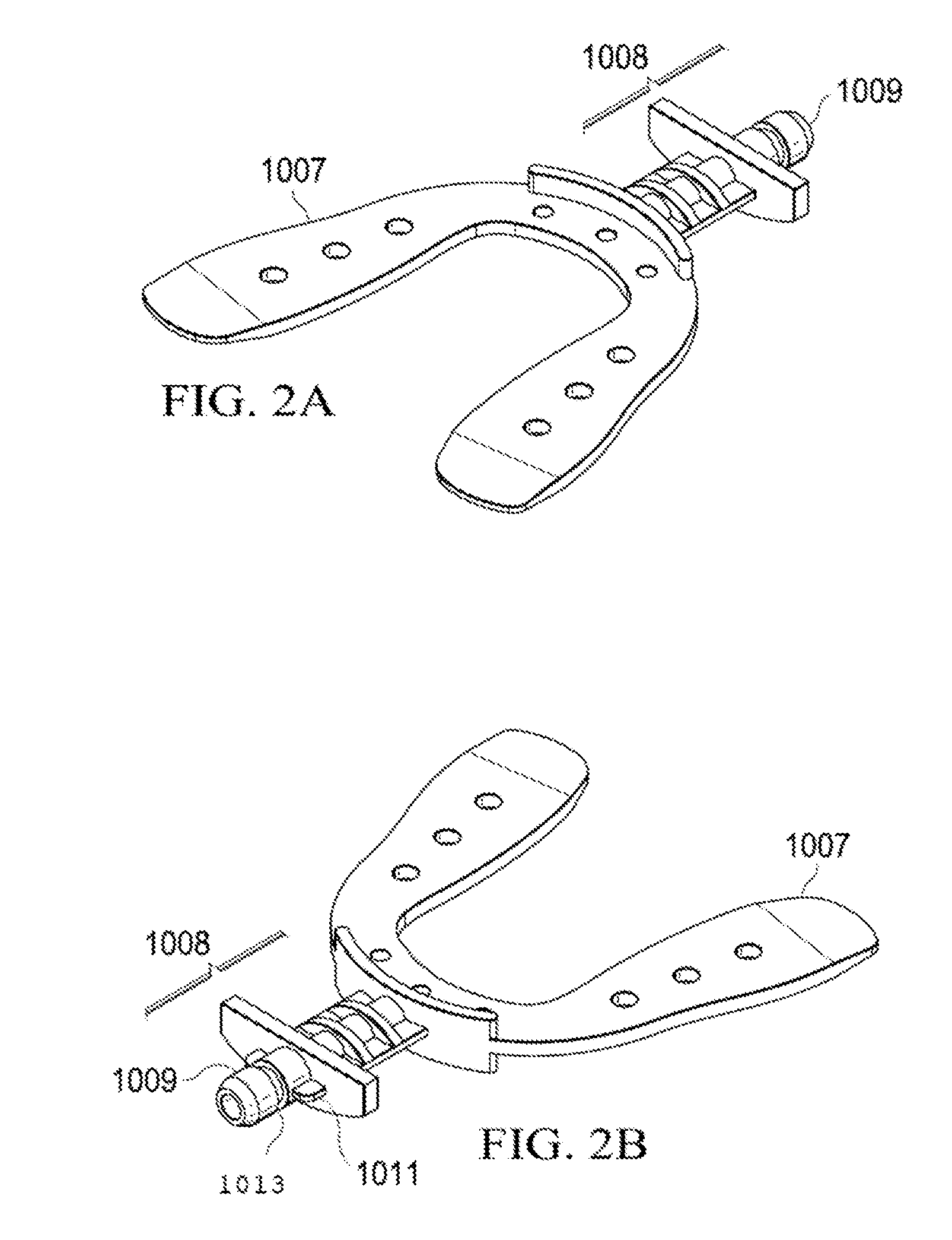 Shapable bite plates