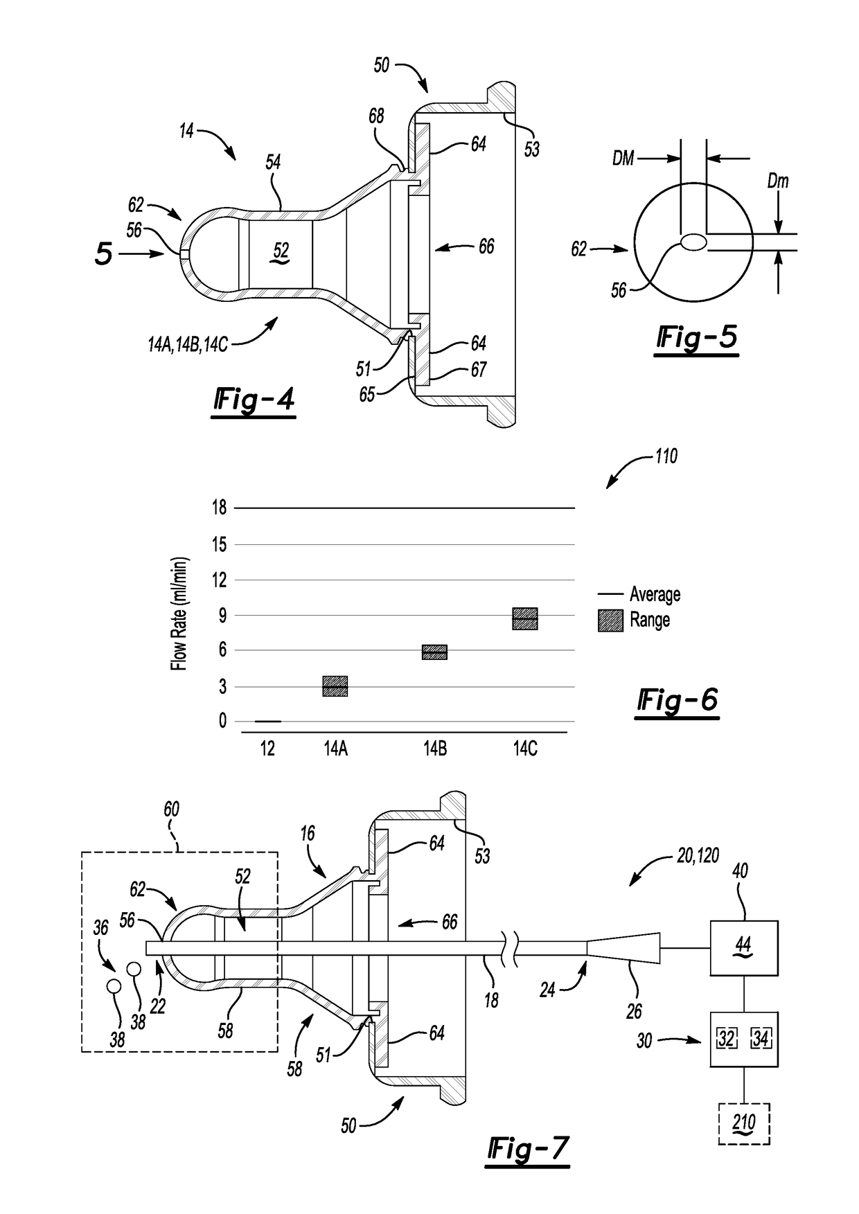 Feeding transition nipple mechanism and system