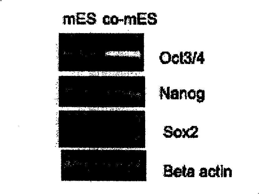 Method for culturing mouse embryo stem cell and its dedicated culture medium