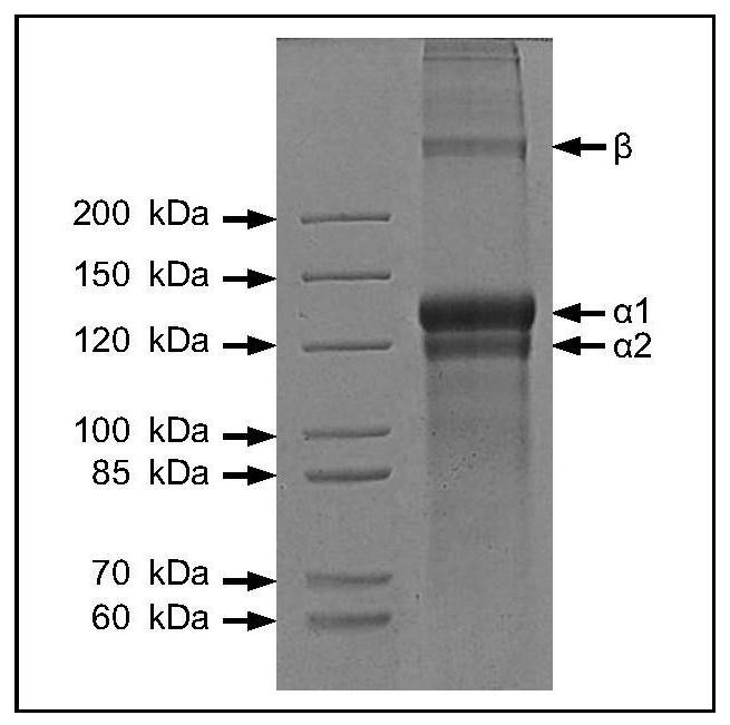 A kind of preparation method of anti-aging fish-derived collagen peptide