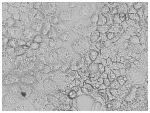 Caco-2 cell monolayer membrane forming culture method