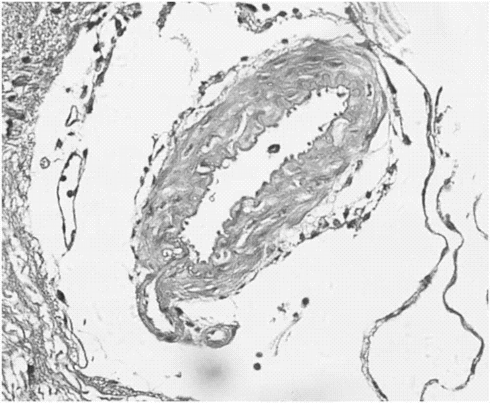 Application of Cystatin C in treating cerebral vasospasm after subarachnoid hemorrhage