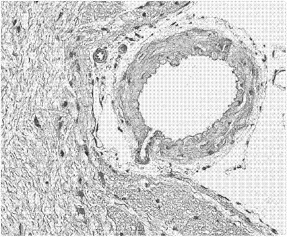 Application of Cystatin C in treating cerebral vasospasm after subarachnoid hemorrhage