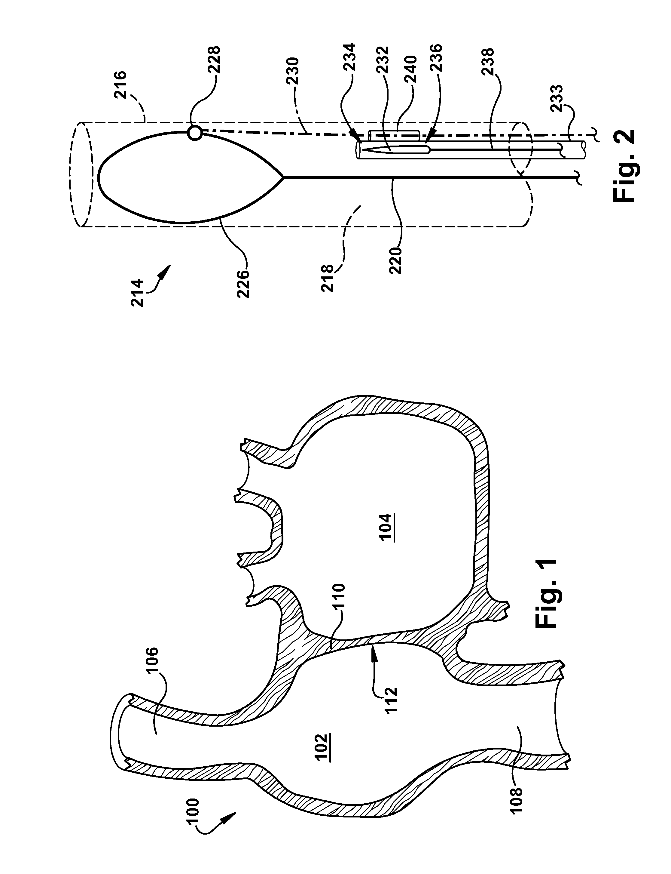 Apparatus and method for targeting a body tissue