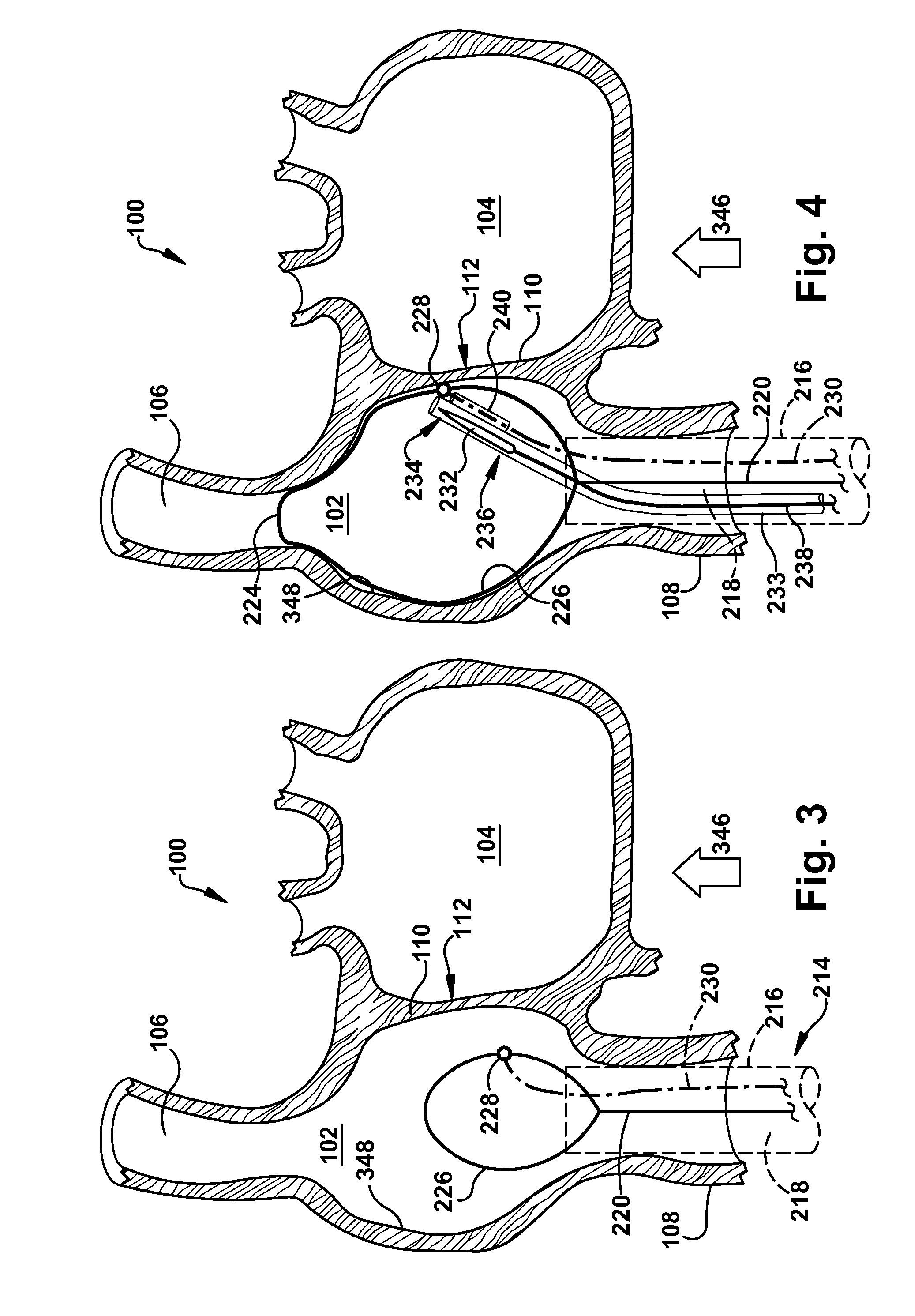 Apparatus and method for targeting a body tissue