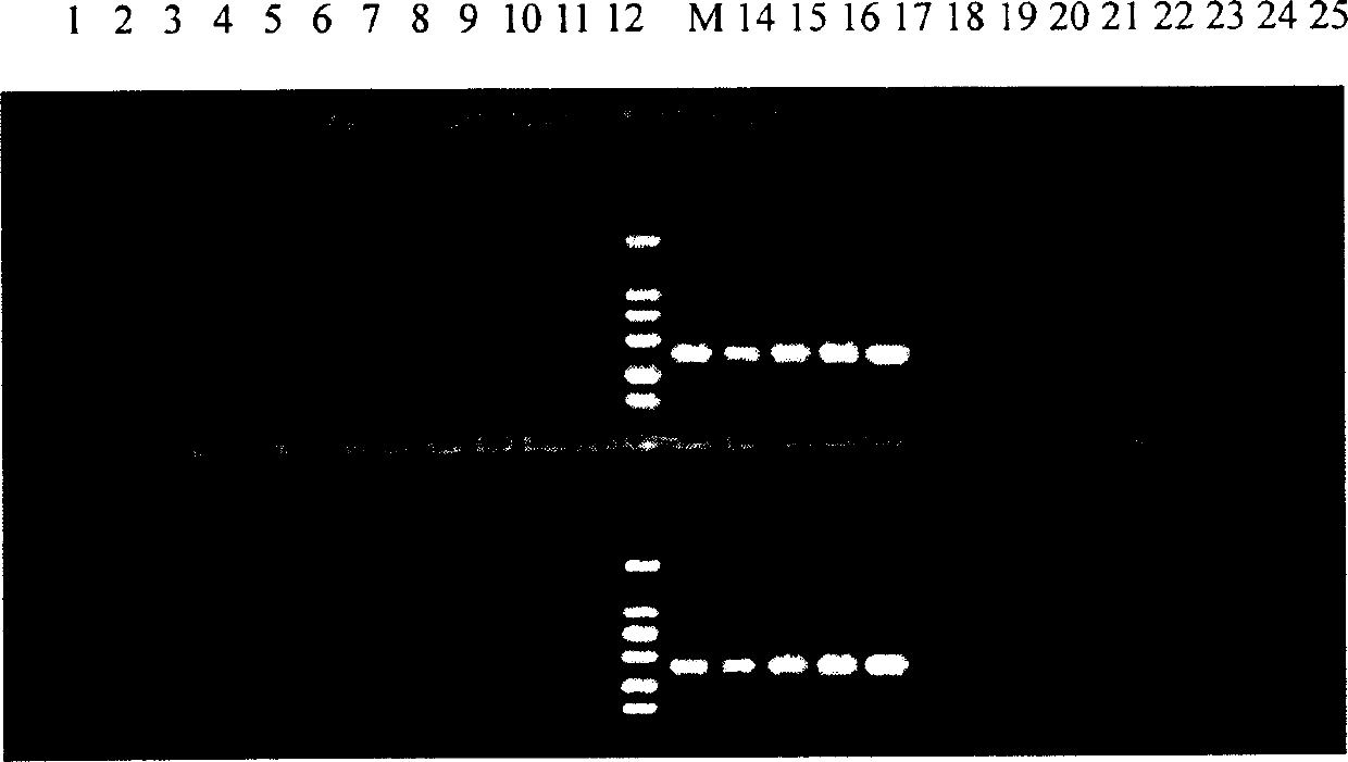 Detecting gene for tomato ulcer germs and detecting reagent case thereof