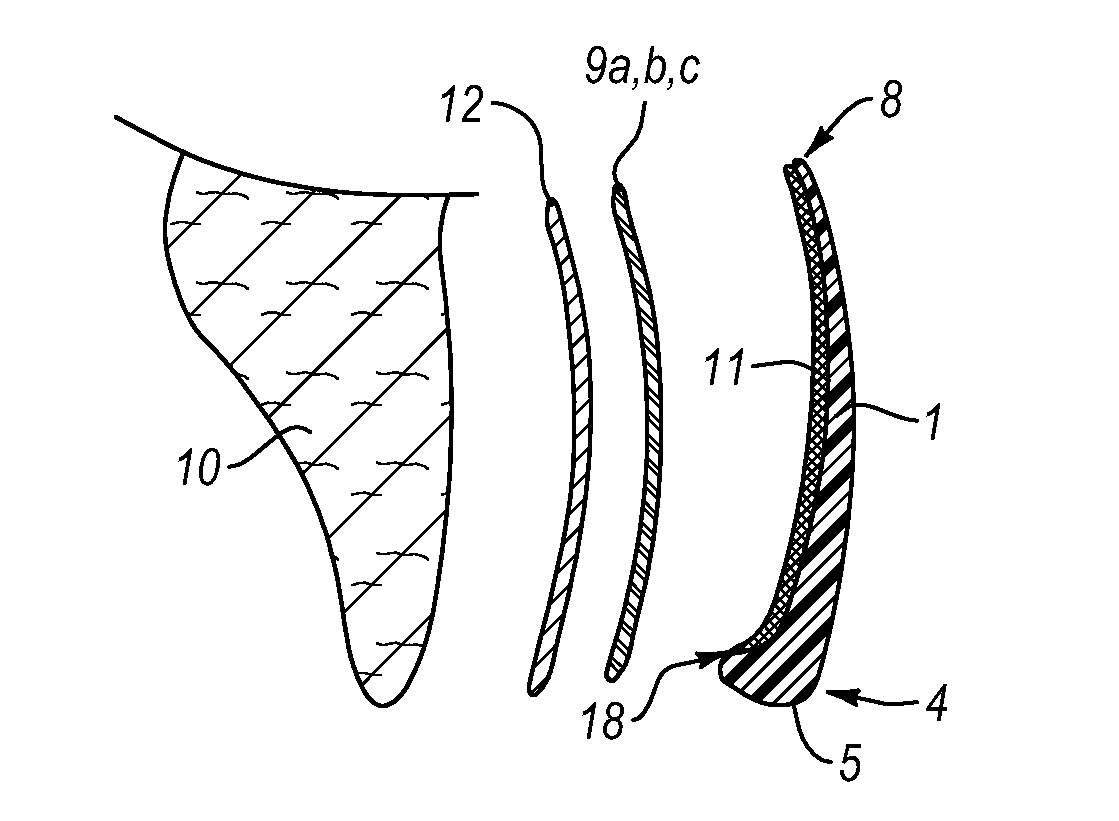 Dental veneers and methods of manufacture