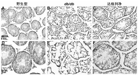 Application of dapagliflozin and analogue thereof in preparation of medicine for preventing and treating male reproductive dysfunction