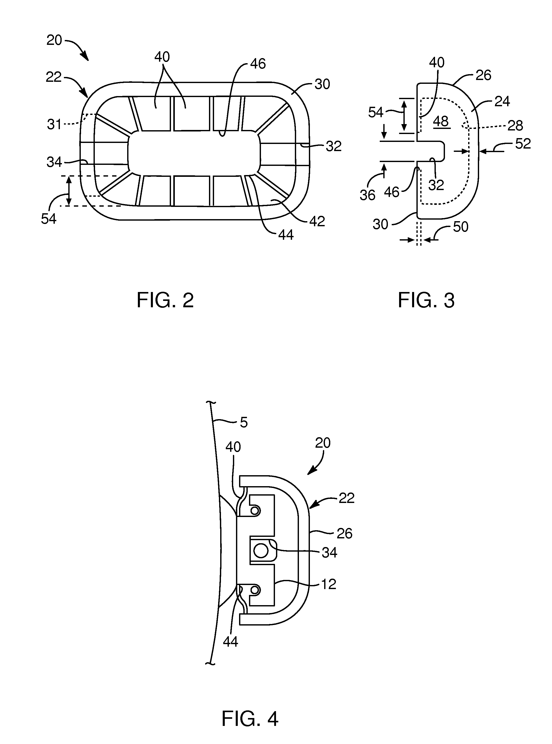 Devices, systems, and methods for orthodontic hardware