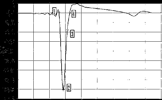 Method for defining and calculating compaction and settlement ratio so as to determine optimal compaction times