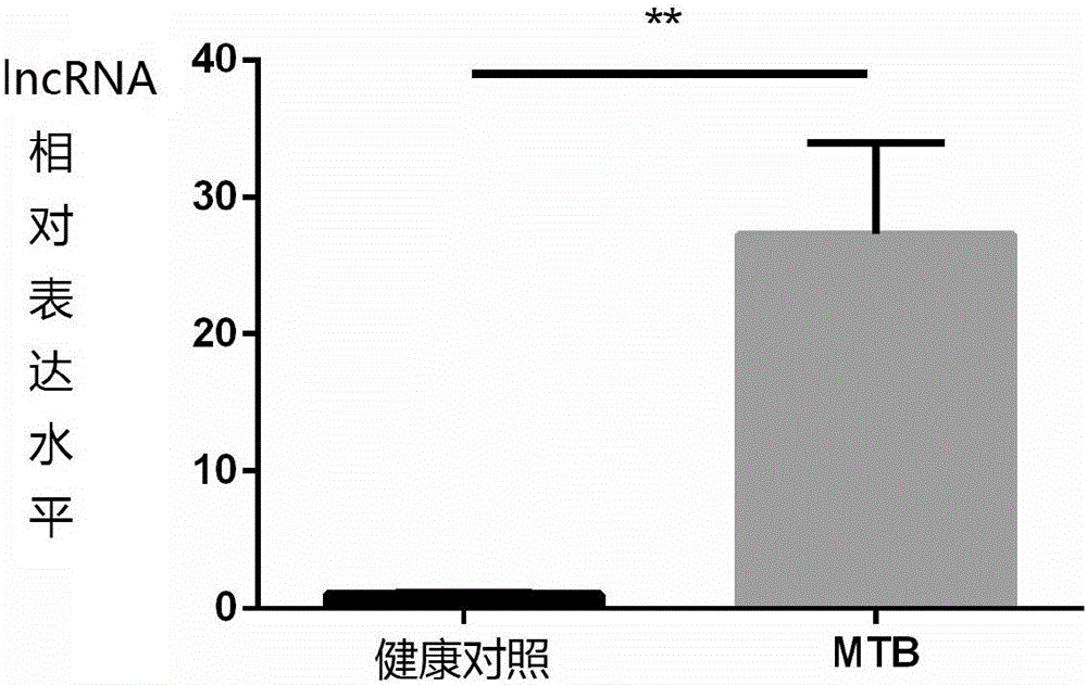 Application of lncRNA (long noncoding RNA)-MIR3945HG V1 in diagnosis of smear and culture negative pulmonary tuberculosis