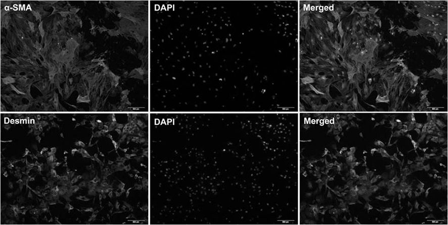 Preparation method and application of immunomodulatory extracellular vesicles