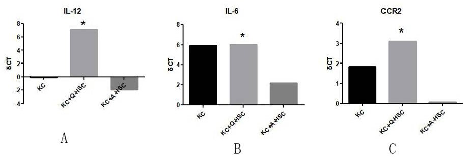 Preparation method and application of immunomodulatory extracellular vesicles