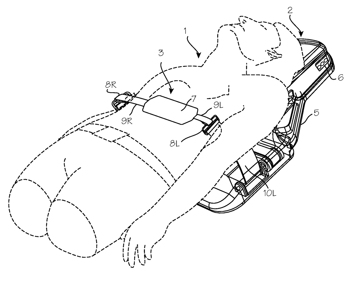 Automated Chest Compression Device