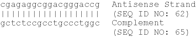 Modulation of glucose-6-phosphatase translocase expression