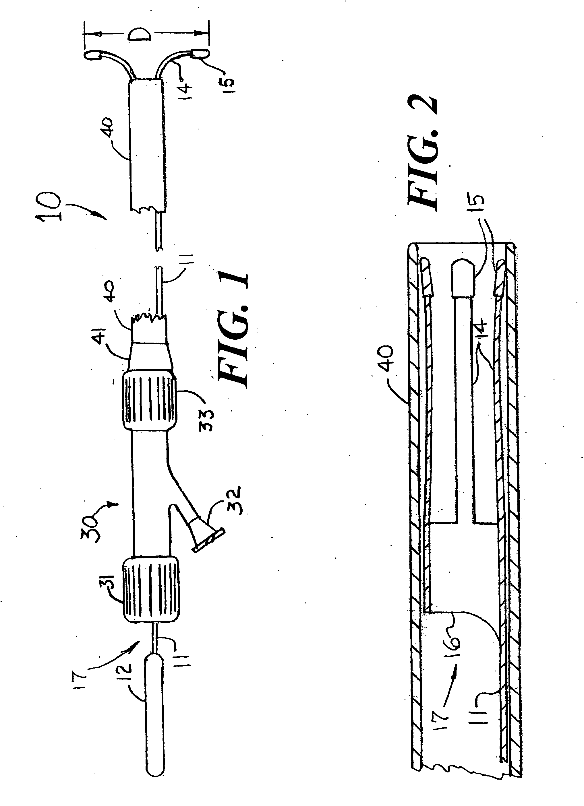 Introducer sheath for the placement of a stent at the ostium of an artery