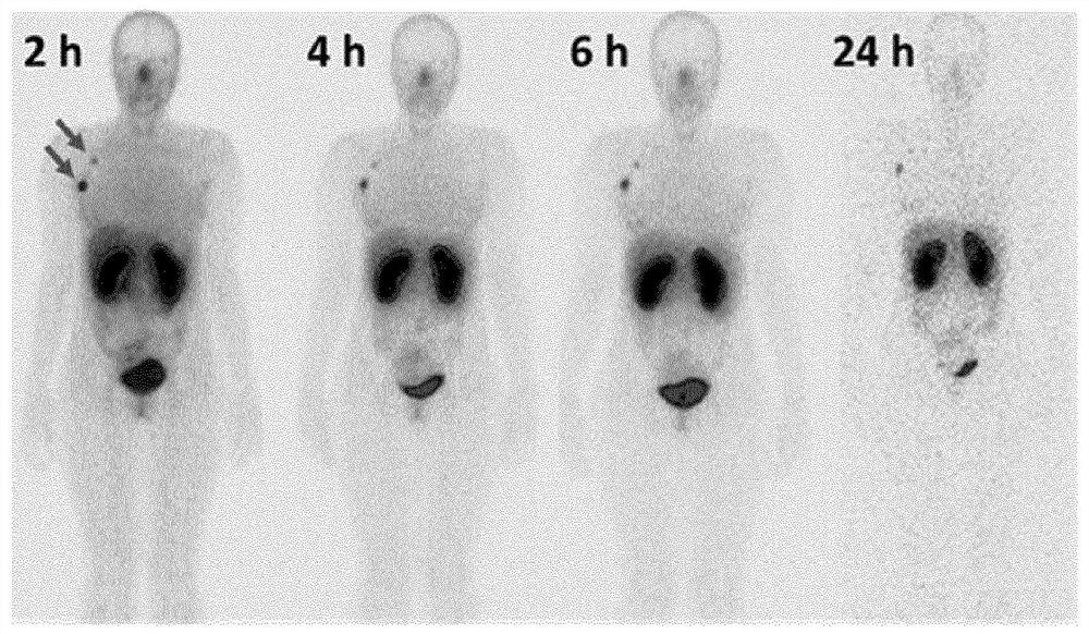 Visualization of HER2 expression in human patients