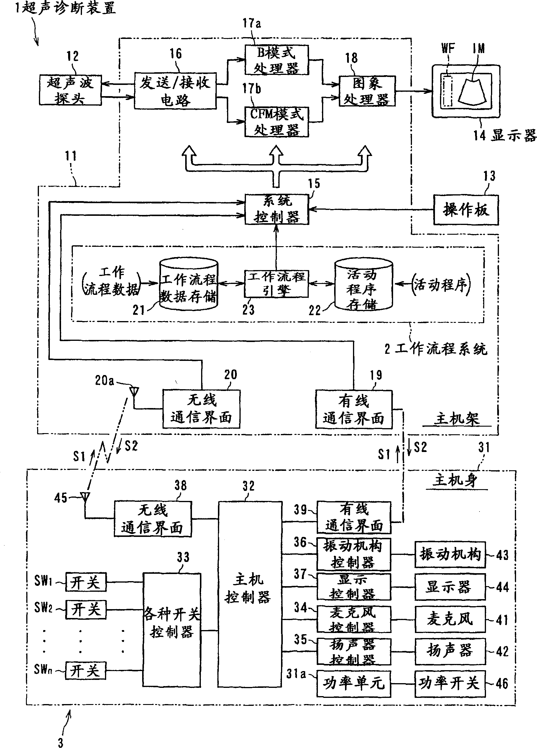 Ultrasonic diagnosis device and operation apparatus