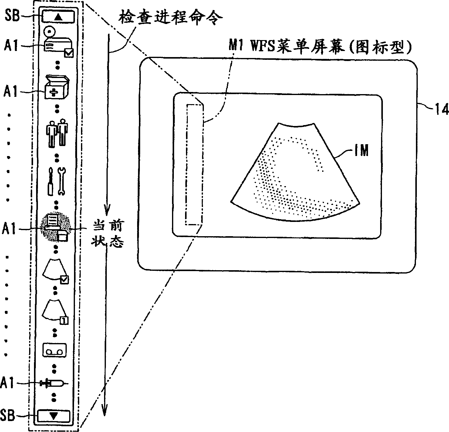 Ultrasonic diagnosis device and operation apparatus