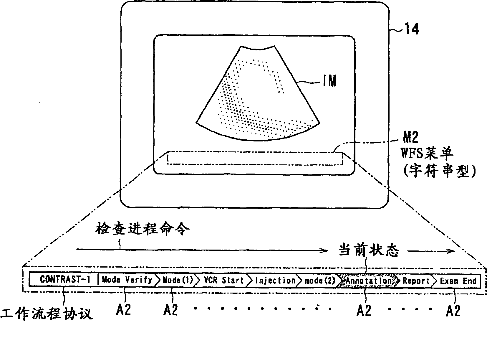 Ultrasonic diagnosis device and operation apparatus