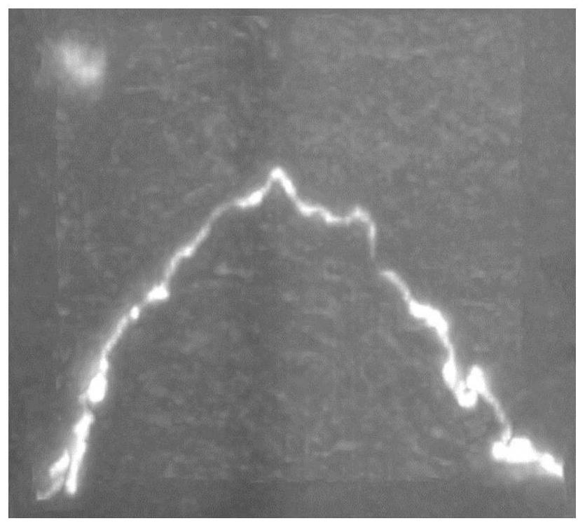 A Nerve Fiber Skeleton Correction Method Based on l1 Norm Minimization Model