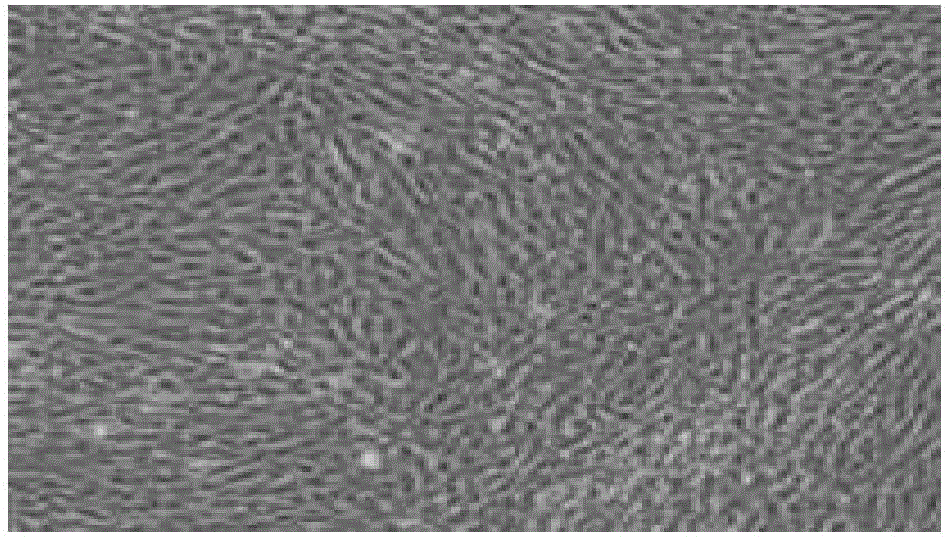 Umbilical cord stem cell wrinkle-removing agent and preparation method thereof