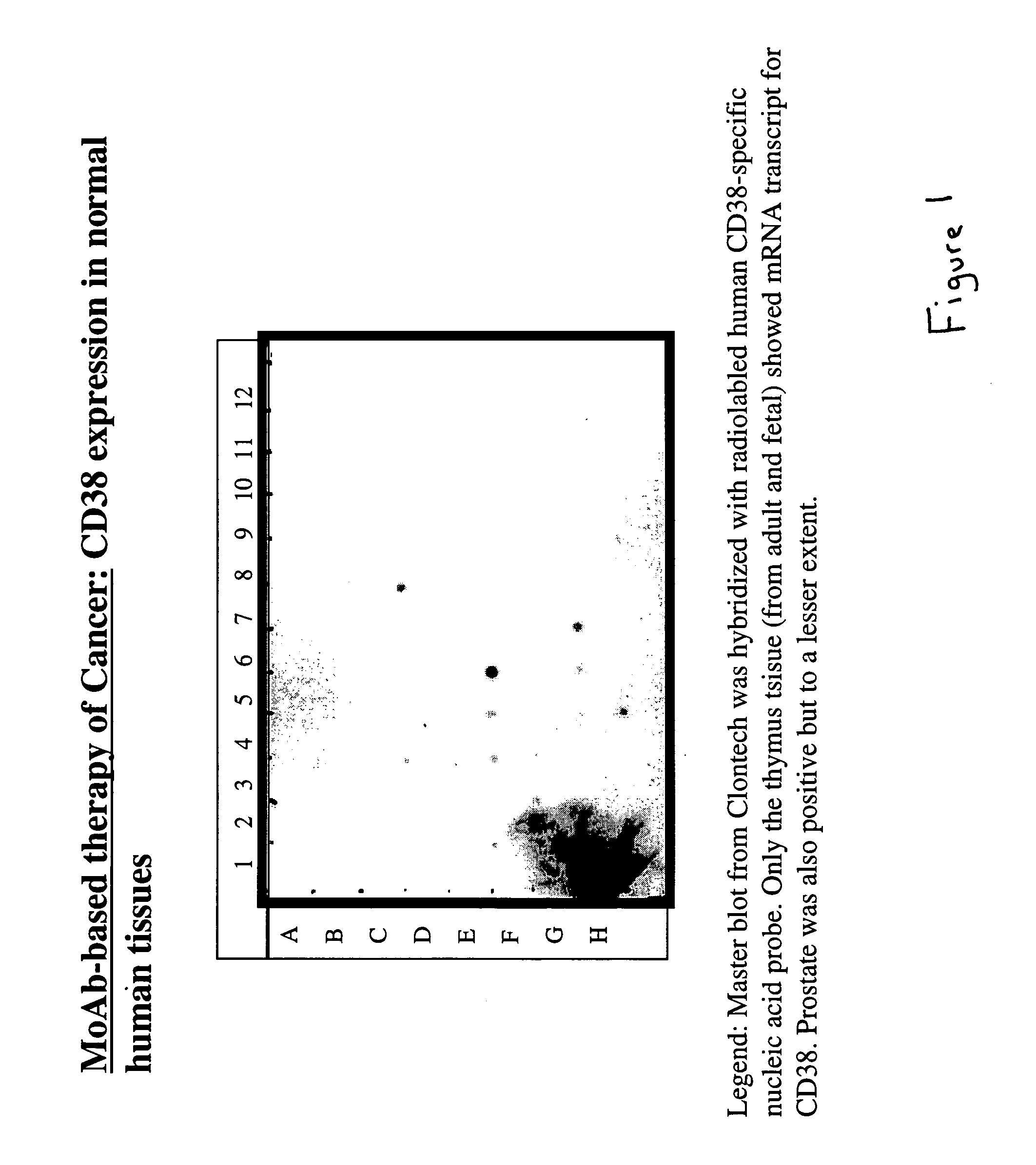 Potentiation of anti-CD38-Immunotoxin cytotoxicity