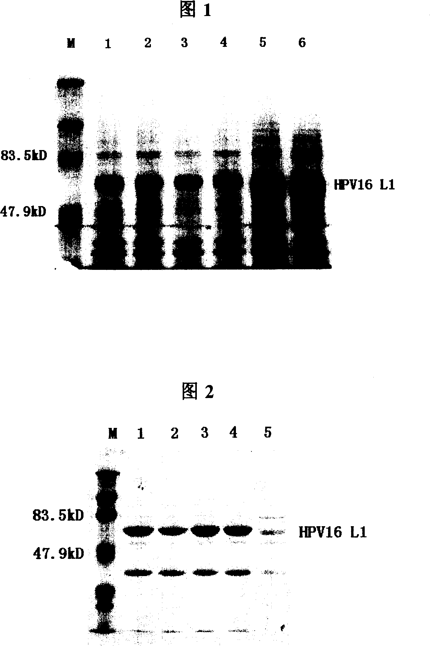 Method for purifying human papilloma virus advanced protein from prokaryote