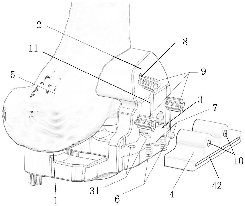 Knee joint osteotomy guide plate