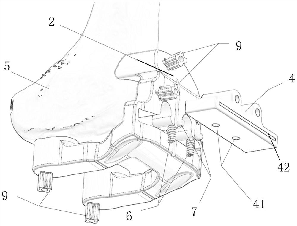 Knee joint osteotomy guide plate